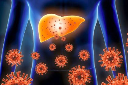 HEPATITIS