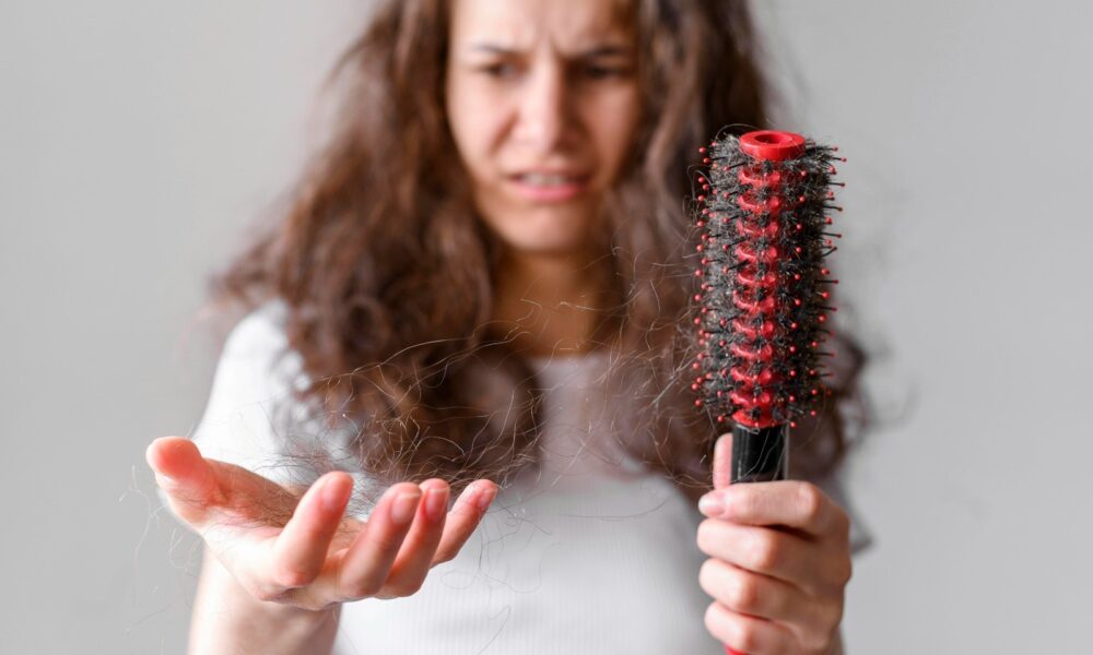 cabello caida