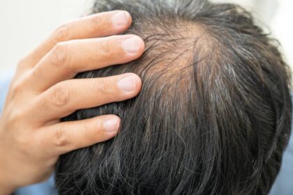 ds friocaida