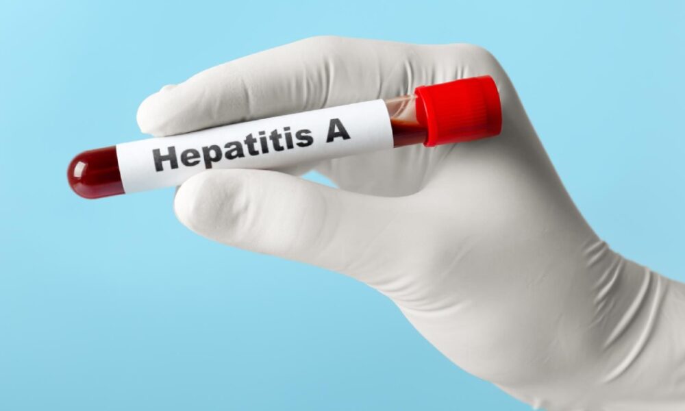 ds hepatitisa