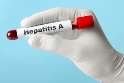 ds hepatitisa