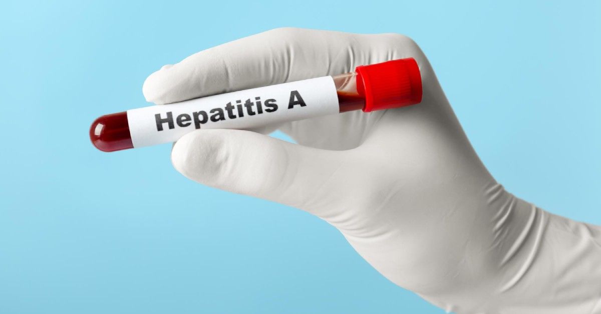 ds hepatitisa